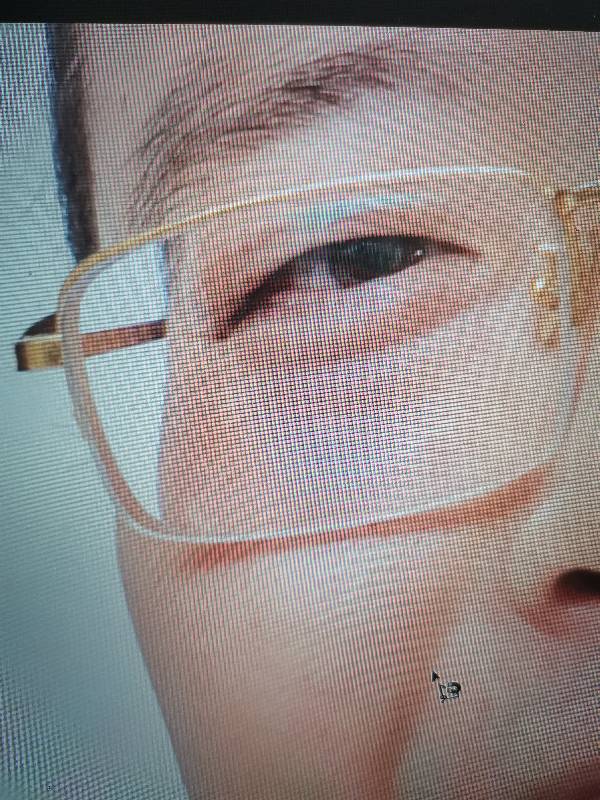 如何PS掉高度数眼镜拍照导致的面部变形？